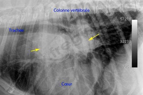 Radiographie des poumons chien Bouvier bernois