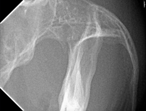 Radiographie de thorax en décubitus latéral droit