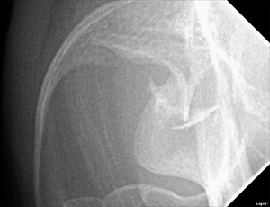 Radiographie de thorax en décubitus latéral droit