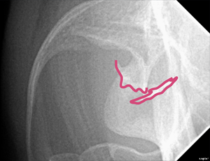 Radiographie de thorax en décubitus latéral droit